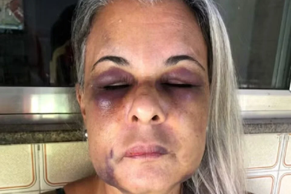 Professor de jiu-jítsu é preso após agredir ex-mulher por seis horas no RJ