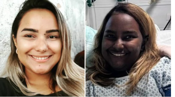 Entenda como tumor raro fez pele de brasileira mudar de cor